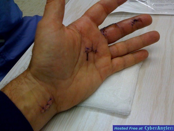 Randy's hand